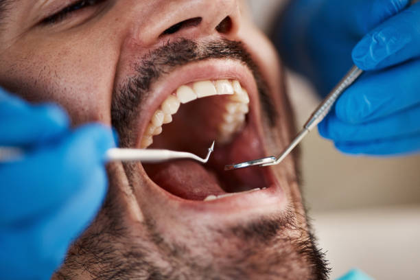 Best Urgent Care for Lost Fillings or Crowns in Fosston, MN
