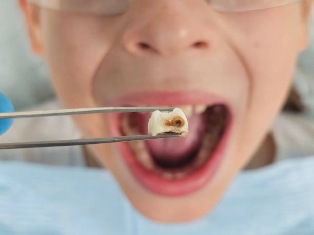 Best Weekend Emergency Dentist in Fosston, MN